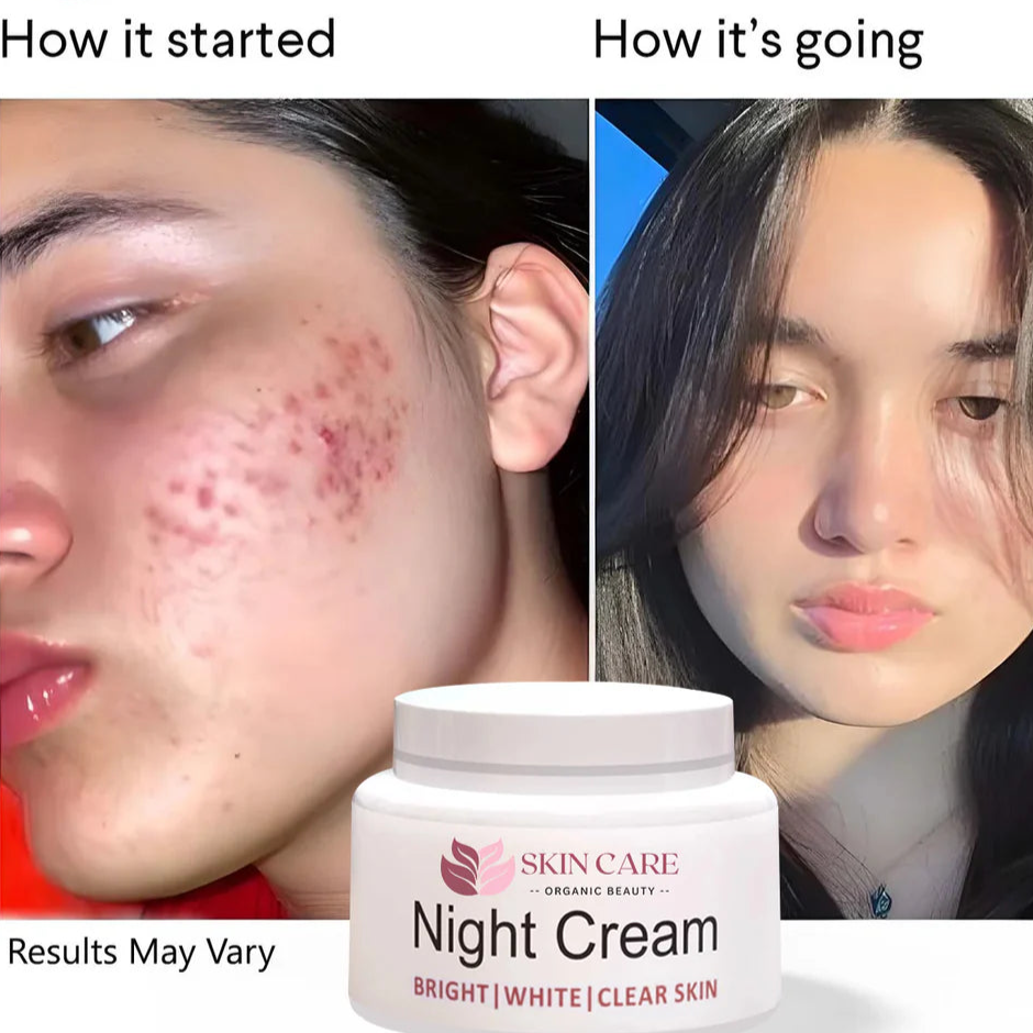 Night Cream - The Skin Care